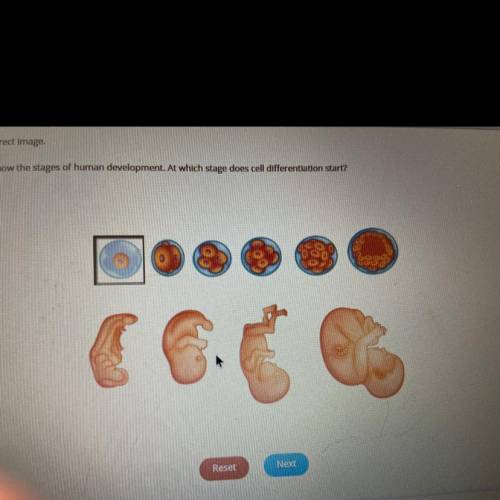Select the correct image.

The images show the stages of human development. At which stage does ce