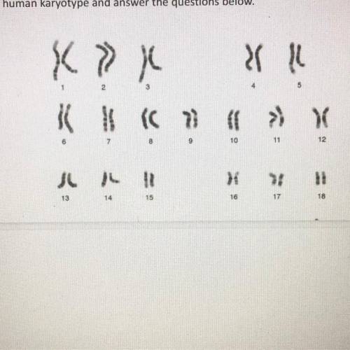 Plzzz help will give brainliest to best answer

Observe the following human karyotype and answer t
