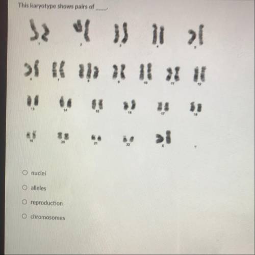 This karyotype shows pairs of

a. nuclei
b. alleles
c. reproduction 
d. chromosomes