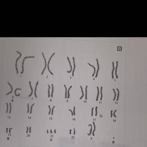 Which part of the karyotype reveals a genetic abnormality?

A. A
В. В
C. С
D. D
plzzz answer serio