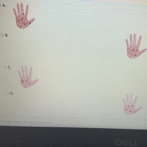 Select the correct answer.
Which hand is negatively charged?