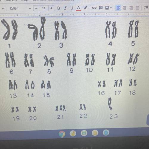 Look at chromosome pair #23. Write the sex chromosomes here. Answer

Which chromosome are abnormal