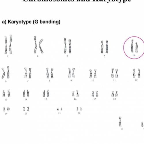 Is this karyotype from a male or female? how do you know ?
Also do they have down syndrome? How?