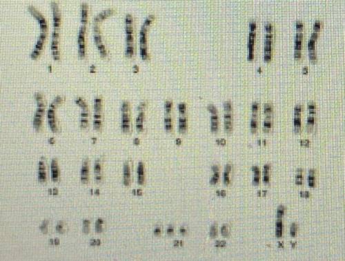1. Patient c:

Using the karyotype below and the chart from the last screen:
A. Determine the sex