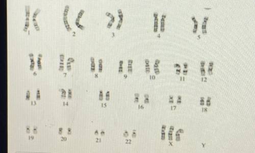 Using the karyotype below and the chart from the last screen:

A. Determine the sex of the patient