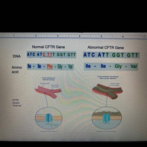 1.Consider the model above compare the DNA sequence of the model and abnormal CFTR gene explain the