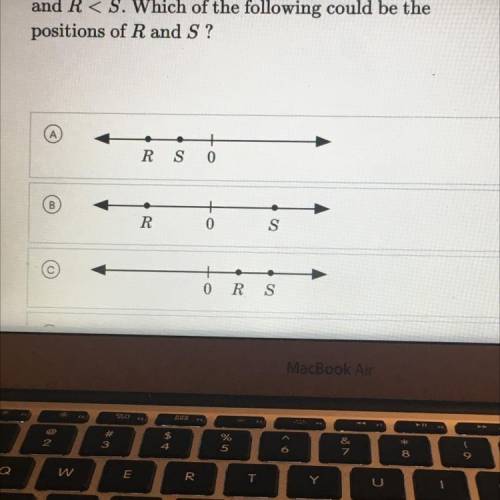 I cant figure out the answer for this lol