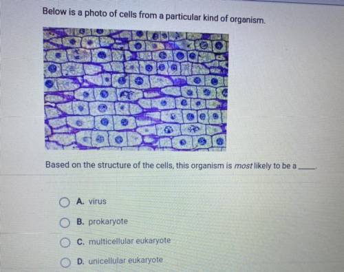 Please HELP IM TIRED OF THOSE BOTS

help me out 
Below is a photo of cells from a particular kind