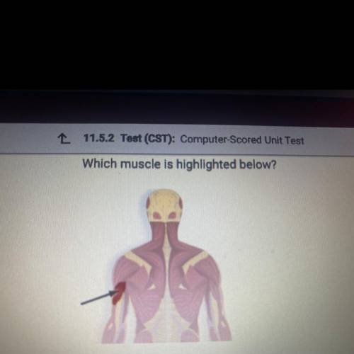 Which muscle is highlighted below?

O A. Obliques
B. Trapezius
O C. Triceps
O D. Rectus abdominus