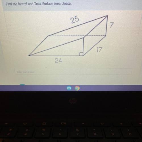 Find the lateral and Total Surface Area