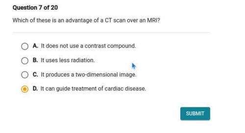 Which of these is an advantage of a CT scan over an MRI?