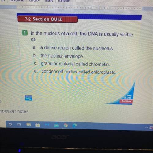 Which is the answer?

In the nucleus of a cell, the dna is usually visible as
A- a dense region ca