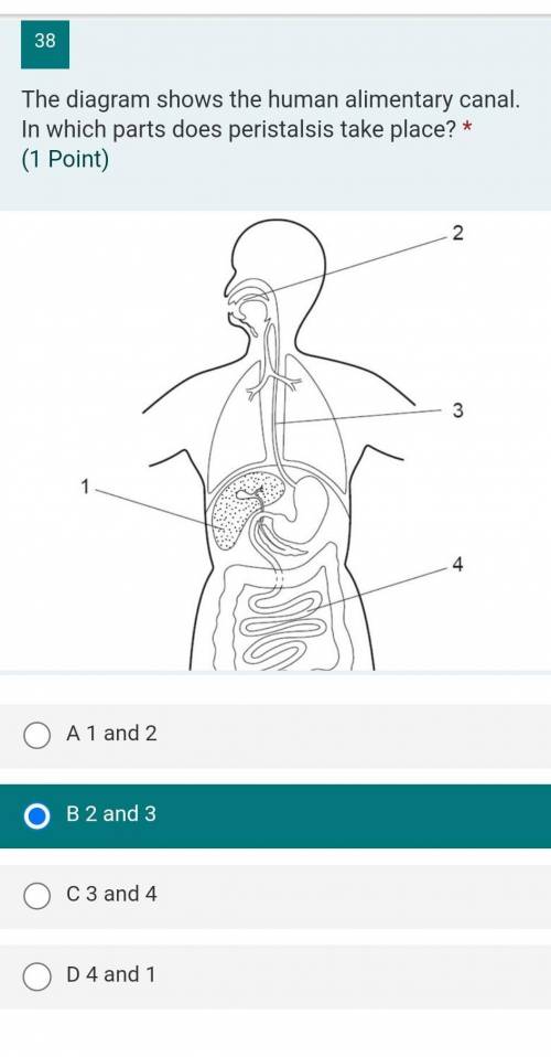 The diagram shows the human alimentary canal. In which parts does peristalsis take place?​ plss be