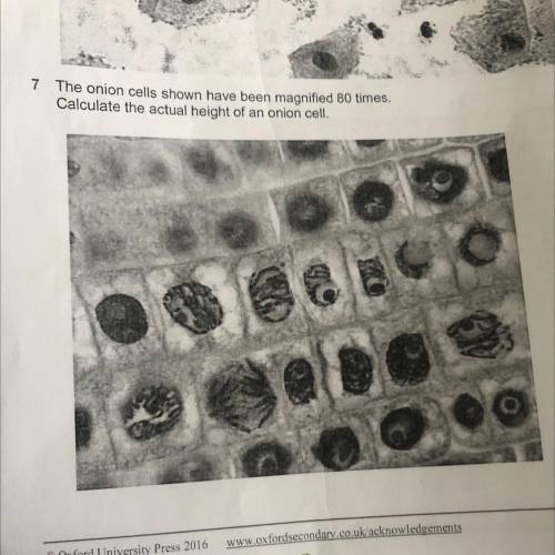 Guys please help me !!! The onion cells shown have been magnified 80 times. Calculate the actual he