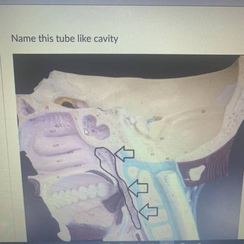 Name this tube like cavity? I think it’s the Esophagus.
