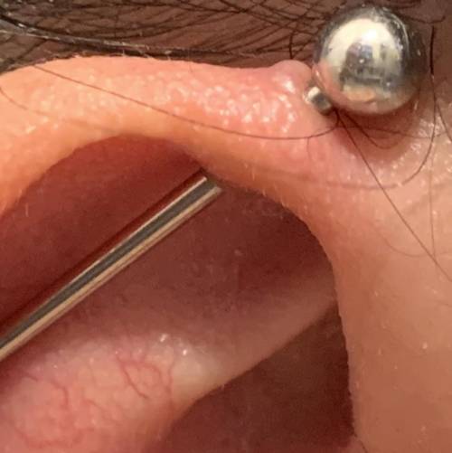 Marking brainliest

Is my piercing infected? I got it done a month ago but it doesn’t hurt unless