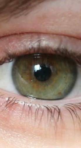What is the rarest eye colour in the world?! Pls help!! It is my BIO homework...