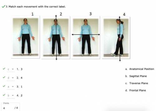 Match each movement with the correct label.

Anatomical Position -- front facing, palms out, legs
