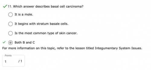 Which answer describes basal cell carcinoma?
pls pst