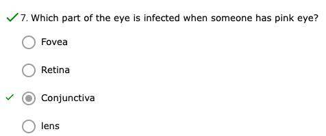 Which part of the eye is infected when someone has pink eye?