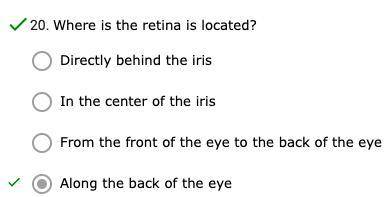 Where is the retina located?
