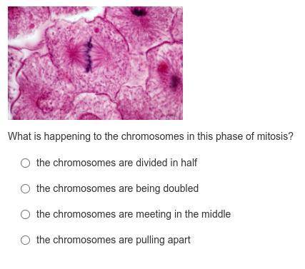 What is happening to the chromosomes in this phase of mitosis?