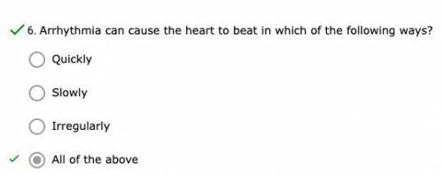 Arrhythmia can cause the heart to beat in which of the following ways?
*d. all of the above