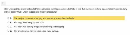 After undergoing a stress test and other non-invasive cardiac procedures, Lethabo is told that she