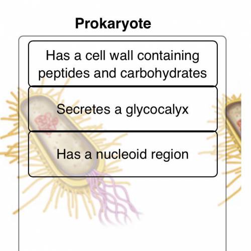 Are the prokaryote’s components right?